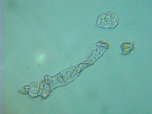 
				vsa ta polimerna vlakna je fotografiral Vladimir Prosenik iz dežja, ki je padal na nas pred dvema dnevoma. 			
