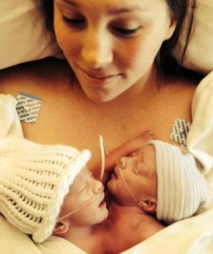 Garrett in Andrew Stancombe, siamska dvojčka Garrett in Andrew Stancombe, siamska dvojčka