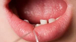 Rezultat iskanja slik za zrijemo zob