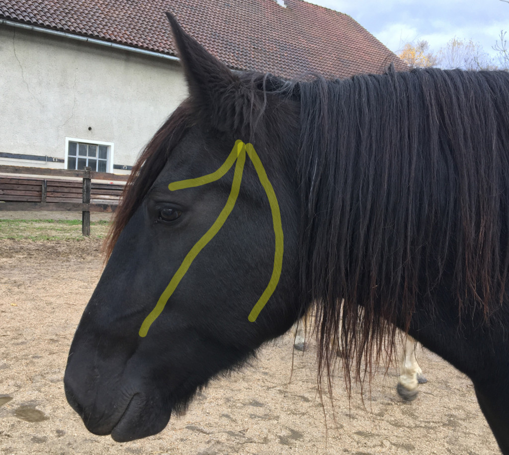 
				Težave s trivejnim živcem so lahko vzrok tako imenovanemu sindromu stresanja z glavo. Kadar je vzrok nevropatija, je stresanje pogosto zelo težko popolnoma odpraviti.			