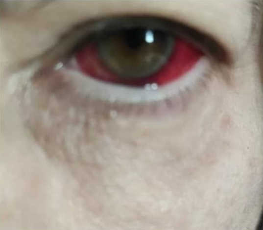 Katastrofa, ki smo jo v Gibanju OPS napovedovali, in svarili smo lani od marca