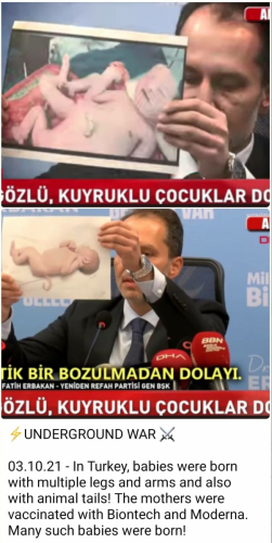 V TURČIJI SE ROJEVAJO OTROCI Z VEČ ROKAMI IN NOGAMI IN Z ŽIVALSKIM REPOM, NJIHOVE MAME SO BILE CEPLJENJE Z BIONTECHOM IN MODERNO