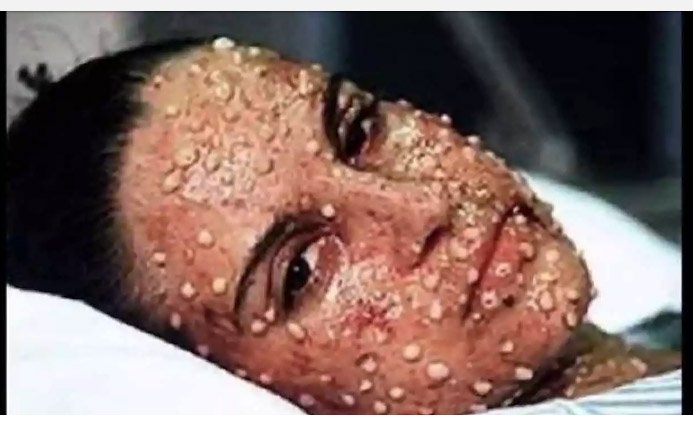 SPLOŠNA NEVARNOST!!!