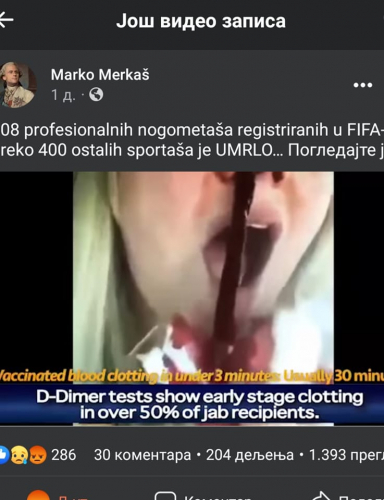 TROMB IZ NOSU, POSLEDICA CEPLJENJA!