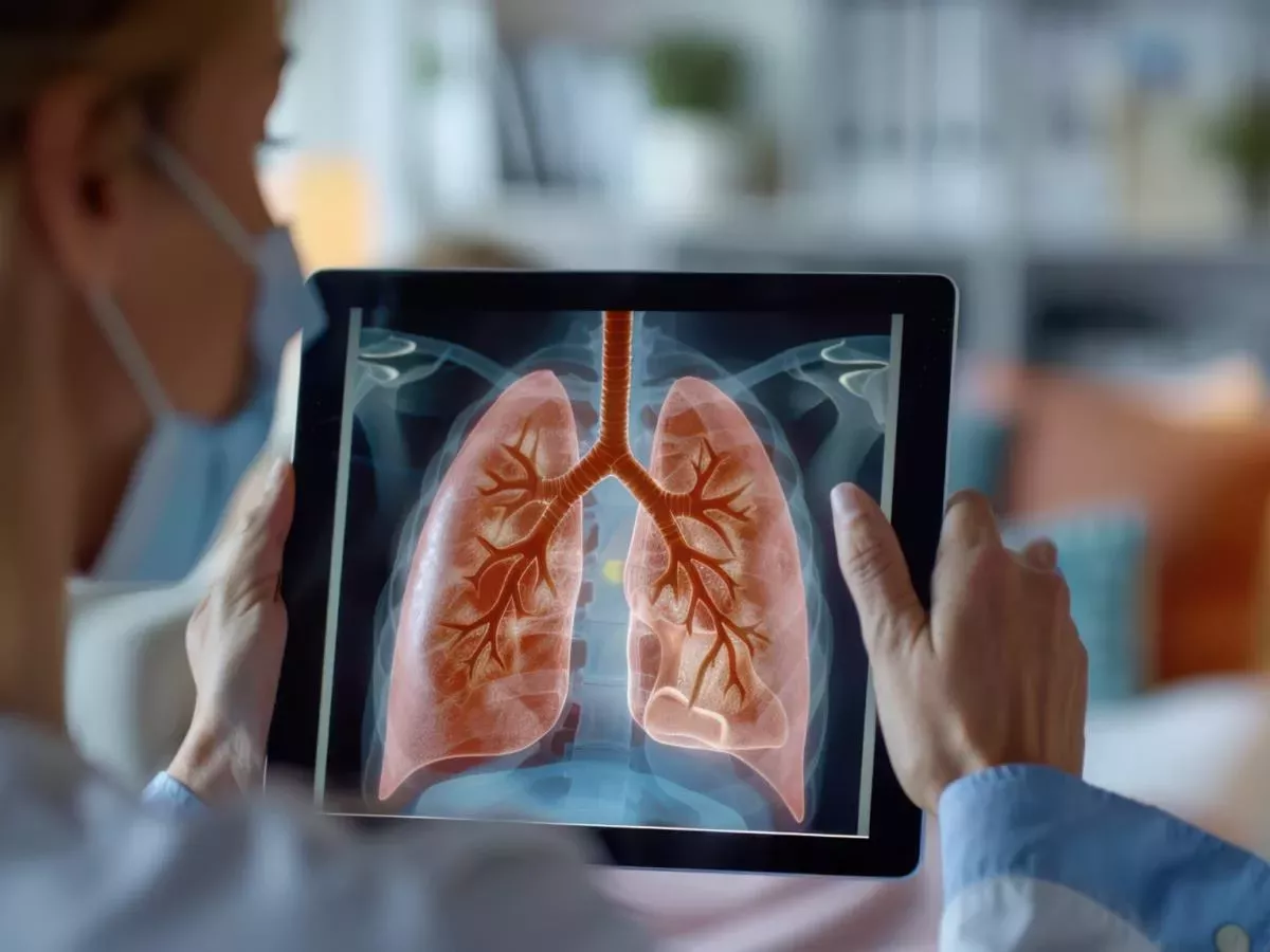 Kako lahko enostavno razkrijemo zgodnje znake pljučnega raka