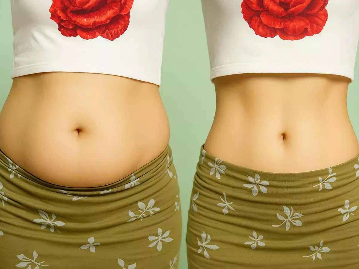 5 vrst velikih trebuhov, ki ne pomenijo, da ste debeli