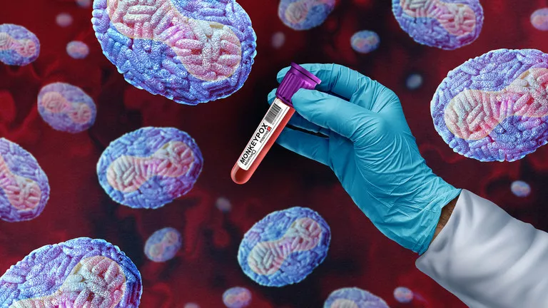 KVA ZDJ – SO RAZMERE, NISO RAZMERE, SO RAZMERE, NISO RAZMERE …